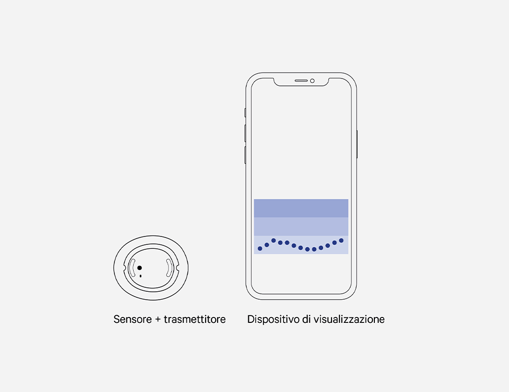 Le componenti di un sistema CGM.
